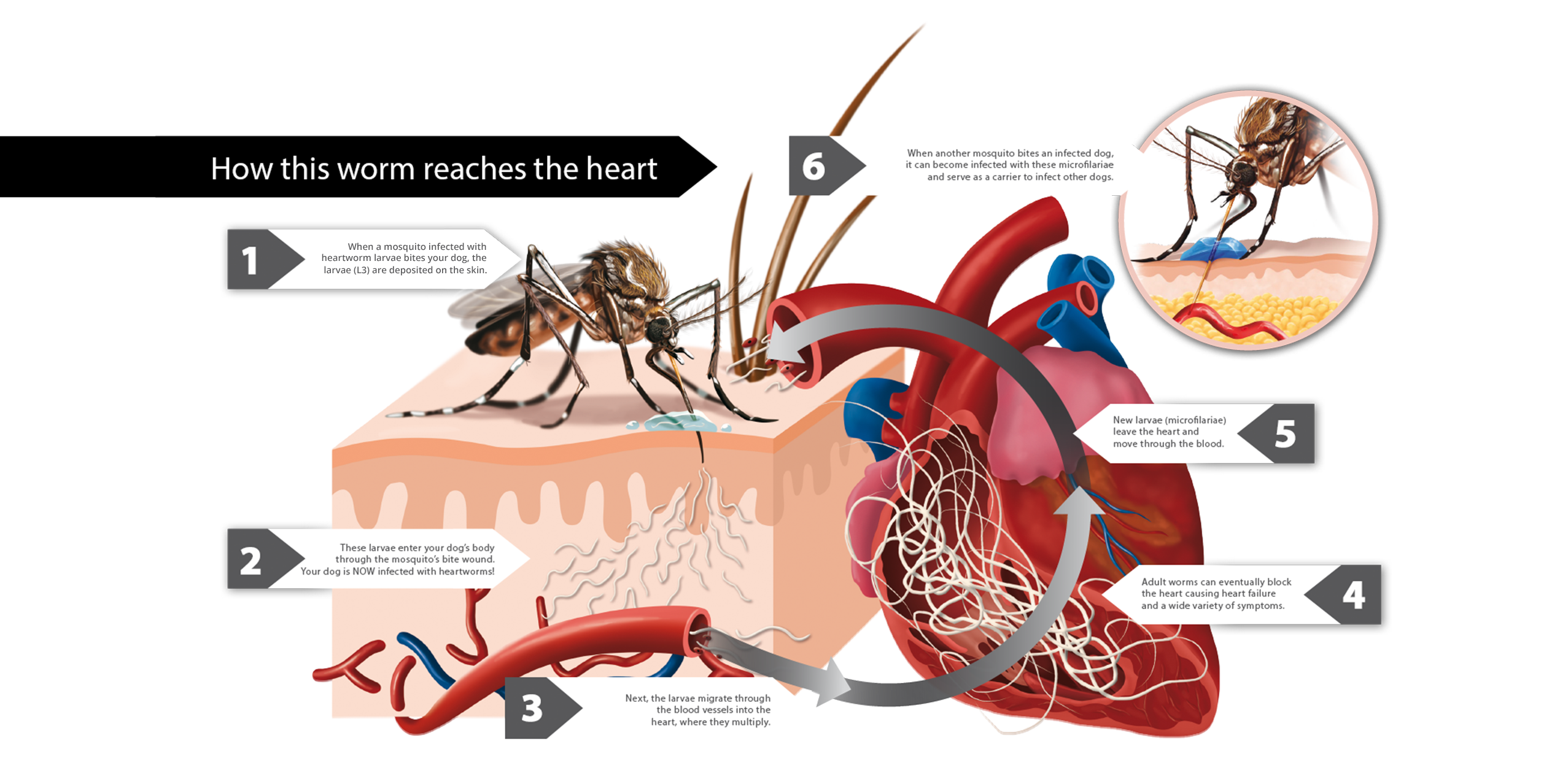 how serious is heartworm in dogs